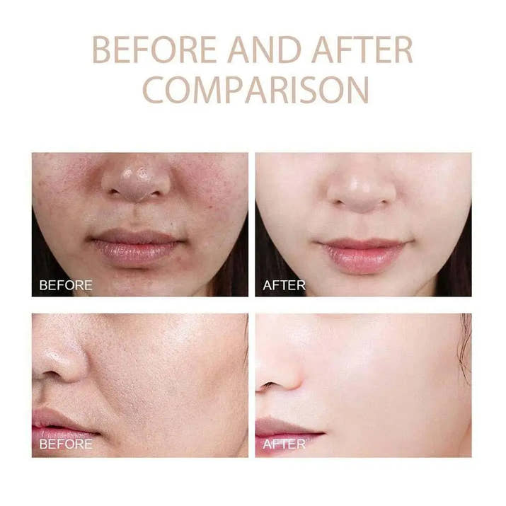Radiant Glow Exfoliating Serum™